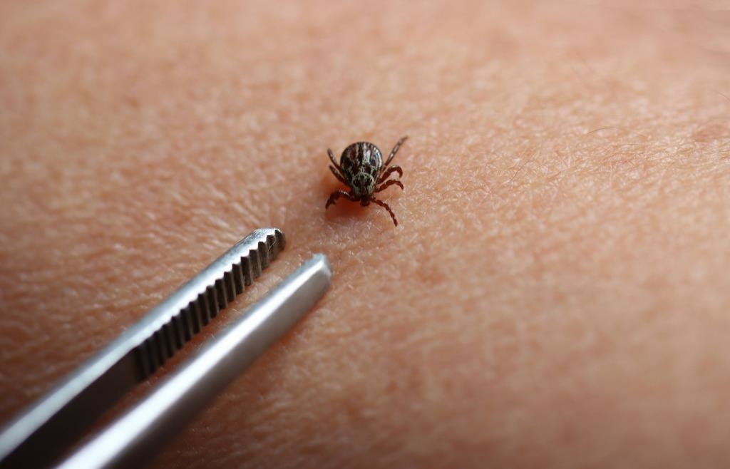Danger from tick bites: Number of deaths and hospitalizations rises