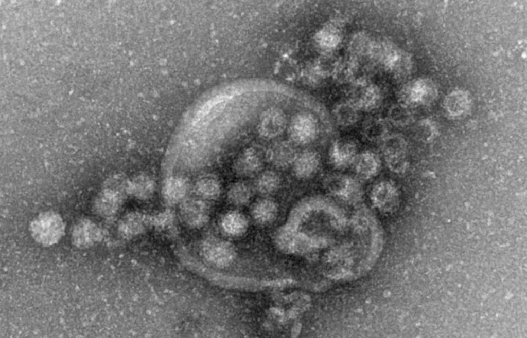 US-Gesundheitsbehörde: Norovirus-Ausbruch auf Aida-Kreuzfahrtschiff